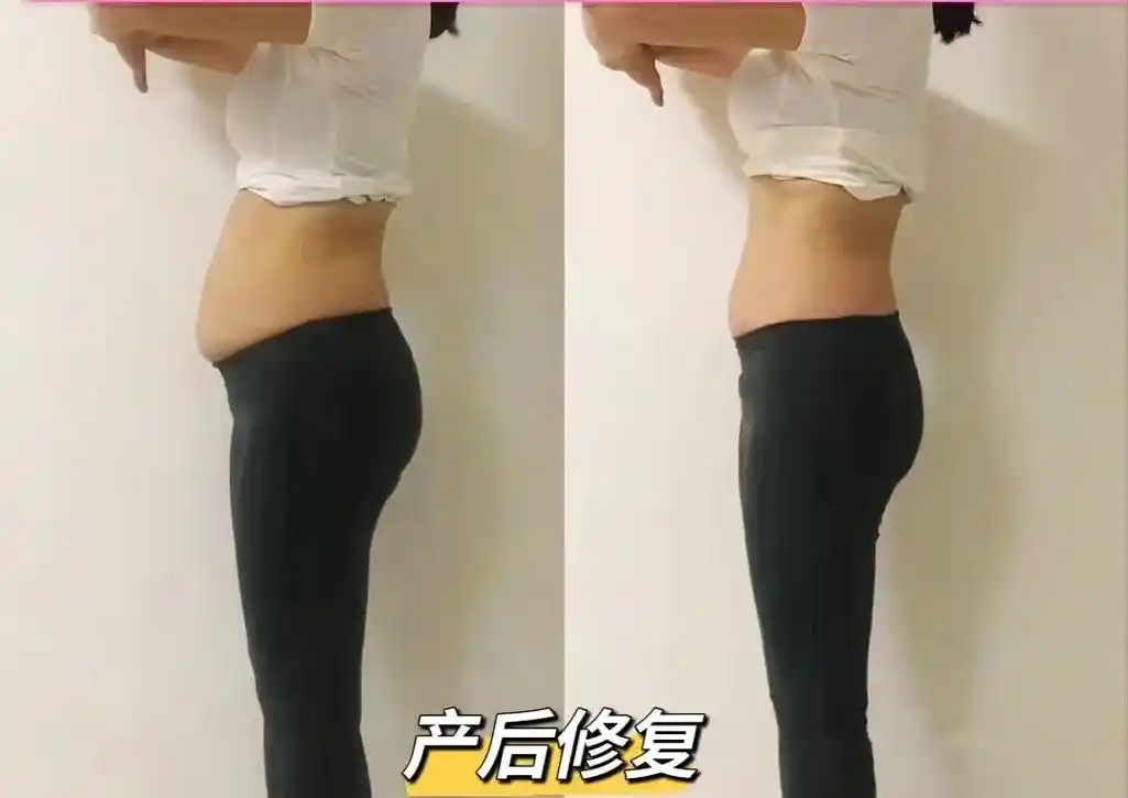 下腹凸出的表像 实质是内脏下垂 如果你躺着的时候肚子很平 一 - 抖音