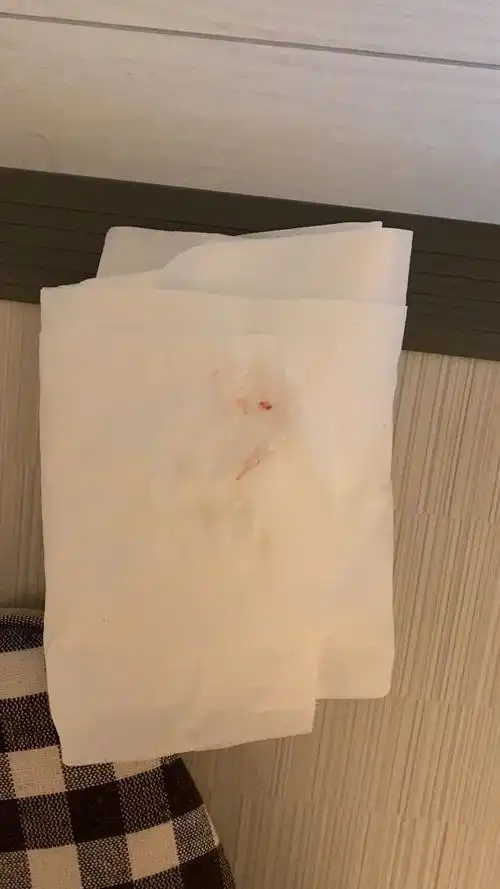 慌忙!同房出血是什么原因造成的"基因筛查"-第1张图片-太白博客