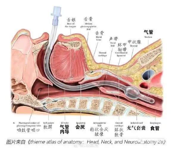 咱也不说非要请医学指导了,但凡查查资料看看科普,也不至于把气管导管