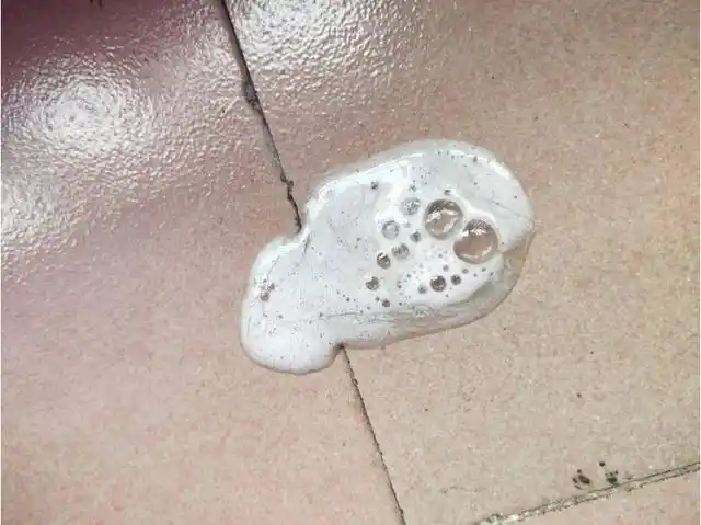 查看4种痰液,或可知道肺部的变化,不如自检一下