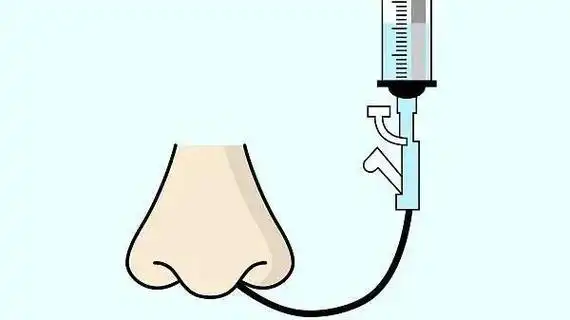 留置胃管并没有想象中那么可怕_腾讯新闻