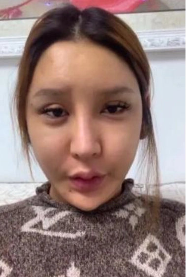 原创女网红沉迷整容却越整越难看近照嘴巴肿成香肠嘴承认自己整容失败