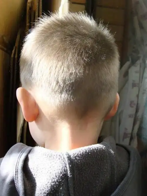 枕骨饱满,脑骨大而有势,顶骨凸起,额骨宽展,左右颧骨相辅助,这就是人