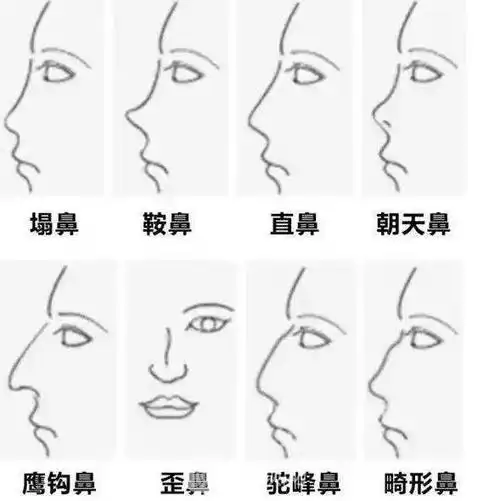 鼻子不完美,别说侧颜杀了,什么都不好看!