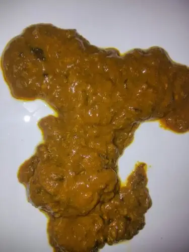 老是大便一天好几次,老是想大便,只拉一点点,一会儿就有大便,不拉也