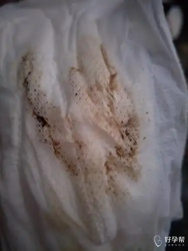 吃达英一个月,停药第二天就来褐色的