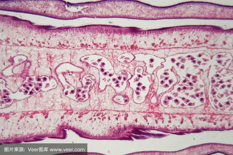绦虫体的一部分(节片)
