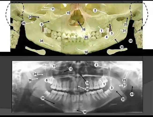 【壹方齿科母亲节】0元享免费全口腔健康检查 护龈牙刷咖啡杯伴手礼
