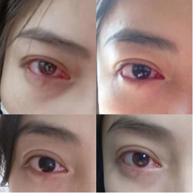 我把大羽绒帽撩起来,露出来我湿漉漉,黏糊糊,猩红色的血轮眼,盯着他