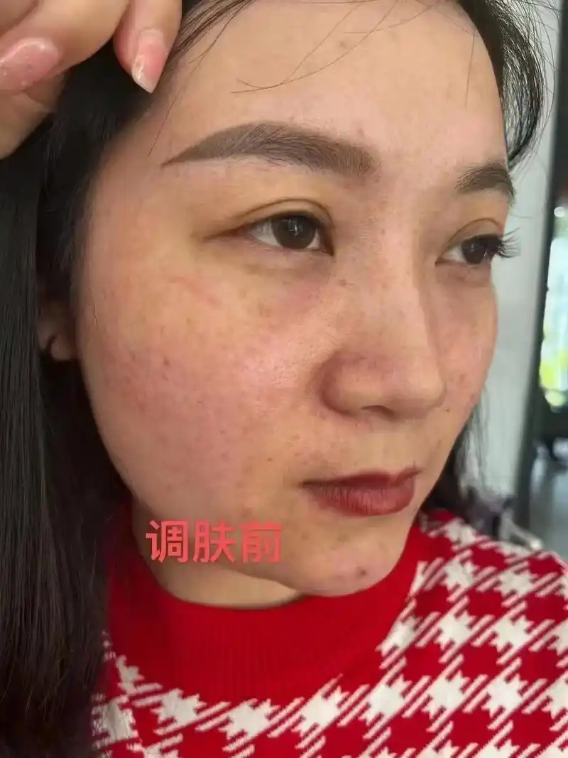 美女顾客祛斑调肤前后对比#身材和脸蛋都需要管理哦#问题性皮肤 - 抖