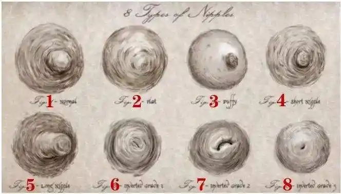 关于乳头内陷的成因及治疗方法(一)_乳头内陷_发病原因_治疗方式_日常