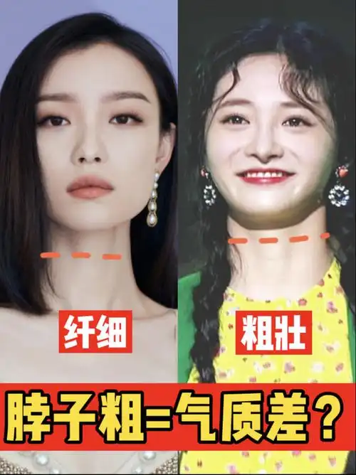 你不是气质差只是脖子太粗了