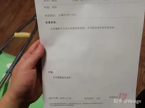 19年11.27号左外踝撕脱性骨折