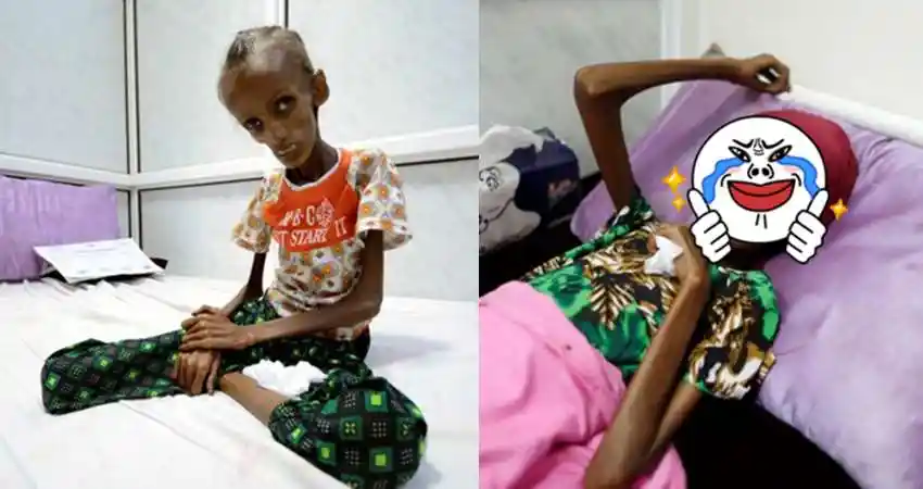 含花待放的少女因为内战的关系骨瘦如柴到像乾尸,结果经过一个月后