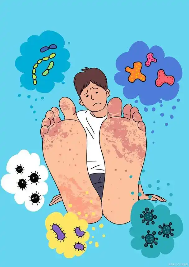 脚气烦恼,没完没了,如何根治脚气?20210928第15期