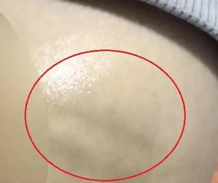 学生弄坏投影仪屁股被班主任打肿,家长闹到学校班主任被罚!