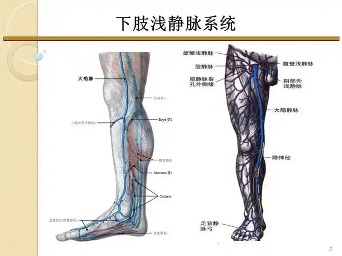 下肢浅静脉曲张的防治