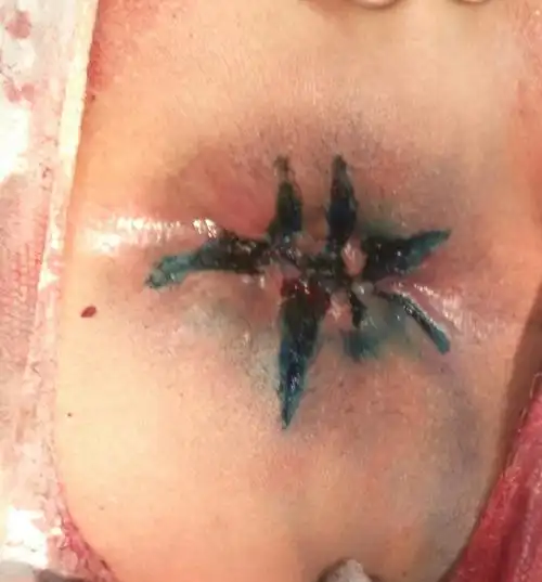 (四联术系列一)