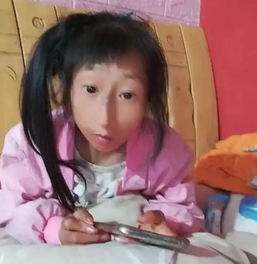 小晓:34岁体重30斤,到底做错了什么,遭到全网谩骂|巴掌|袖珍人|耗子