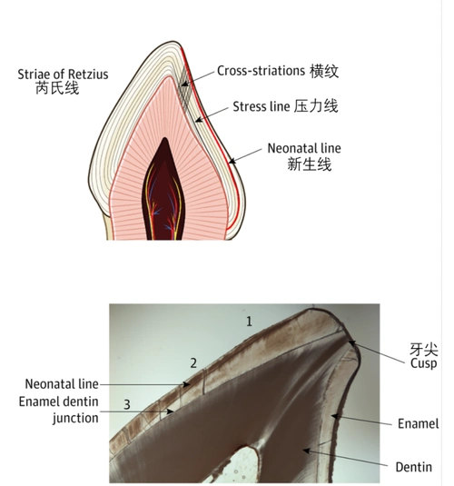 牙釉质横纹和芮氏线的示意图[11]