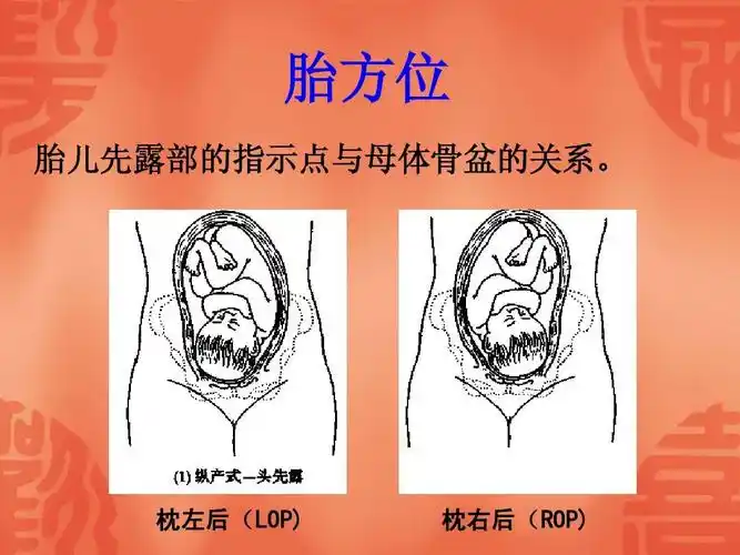 妊娠期妇女的护理ppt