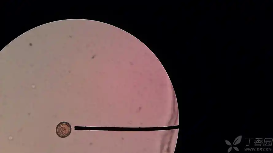 以上3幅为 带绦虫卵