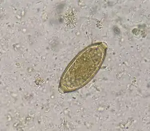 小朋友不养成良好的卫生习惯,可能会感染鞭虫病|寄生虫|虫卵|线虫