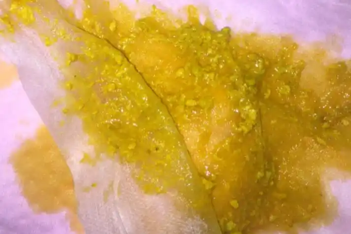 宝宝大便蛋花状图