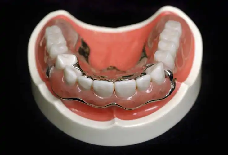 牙齿,无人,横图,吊带,黑色背景,金属,一个,摄影,单个,假牙,齿,牙,牙龈