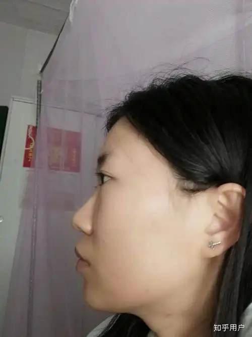 没有山根是种什么体验