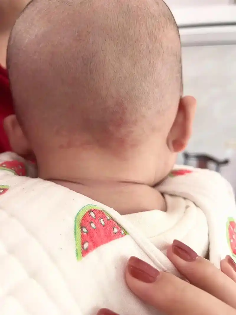 宝宝刚出生以为是胎记,后来才知道它96个好听的名字叫 - 抖音