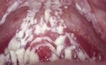 心脏不好女性症状