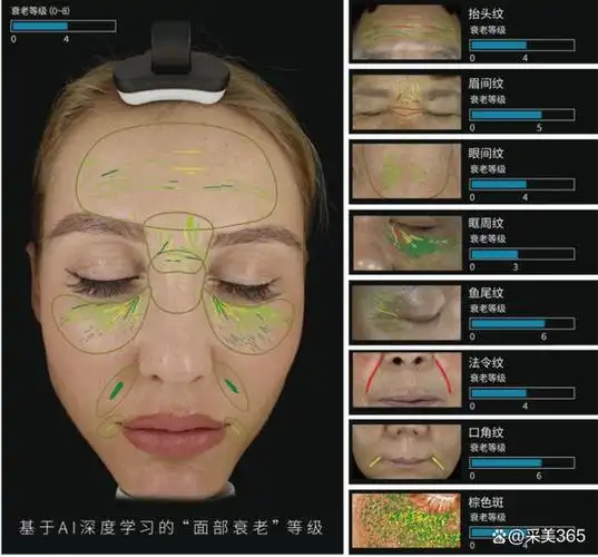 采美新品以色美科d9肌肤影像分析仪上线领跑肌肤检测新潮流