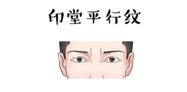 "印堂纹"决定一生富贵,有4种印堂纹的人,天生非富即贵!