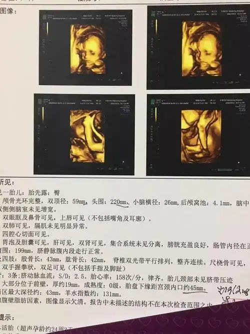 兴奋!胎儿四维彩超图性别"包男孩子"-第2张图片-丙方博客