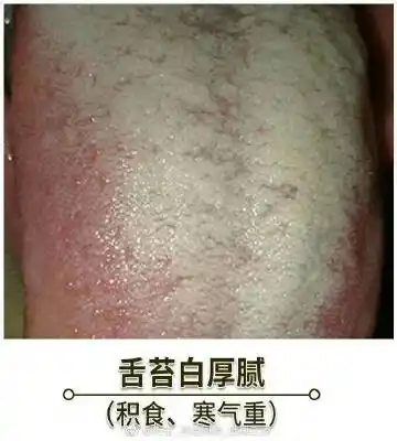 宝宝舌苔白厚腻[疑问]是怎么了0~3个月.