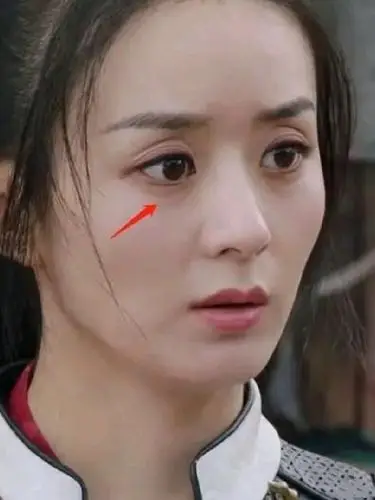 《有翡》热播,我定睛一看,赵丽颖的「眼窝凹陷真的太_圈子-新氧美容