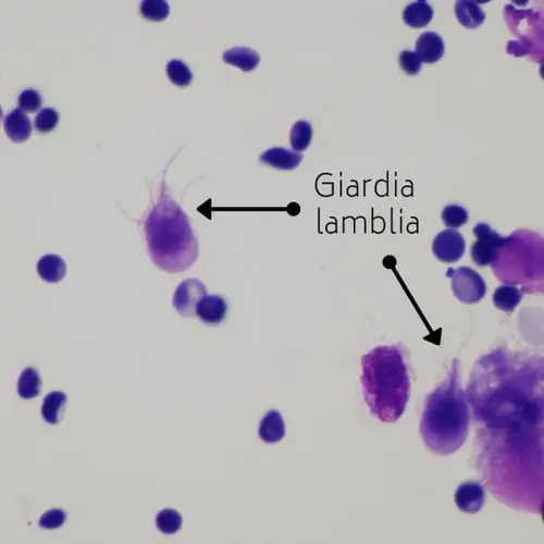 giardia lamblia under the microscope.