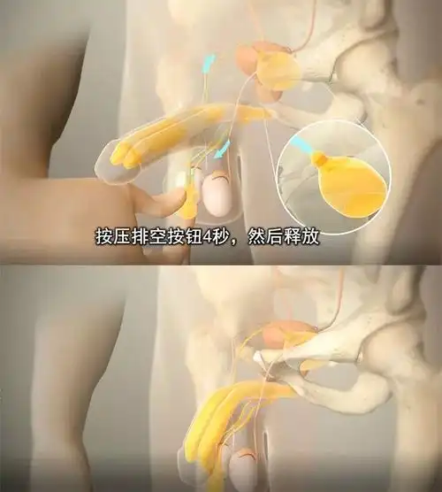 这个神器让你随心所欲,屹立不倒