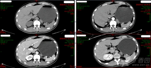 冠状位及矢状位