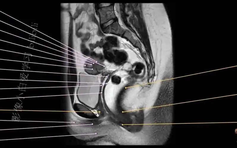 7.盆腔mri解剖图谱-女性盆腔mri解剖