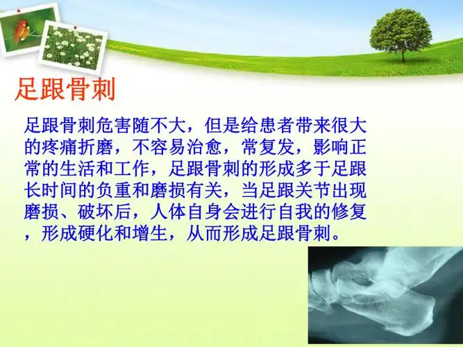 治疗足跟骨刺的方法