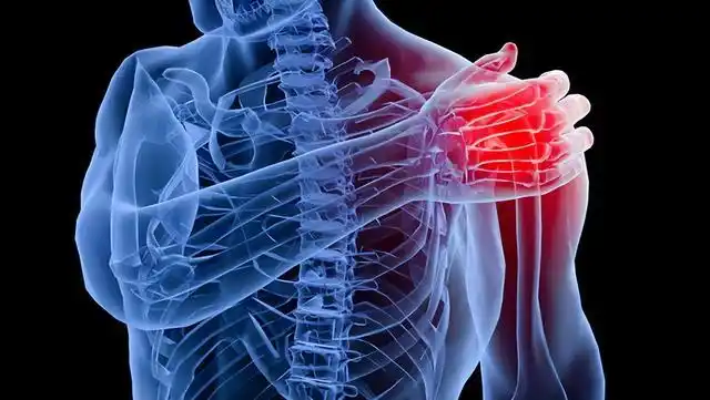 手麻,肩胛骨区域疼痛,是哪里的问题?