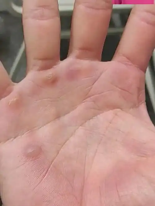 晒伤的皮肤 分层的肤色 半夜三更起来站岗 手心布满了一层一层的老茧