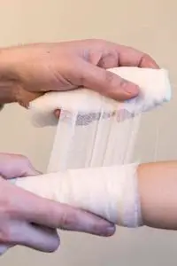 包扎手臂照片图片