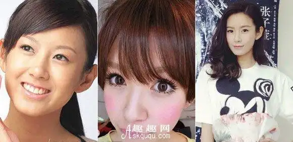 张子萱承认整容整容前后照片对比差距大