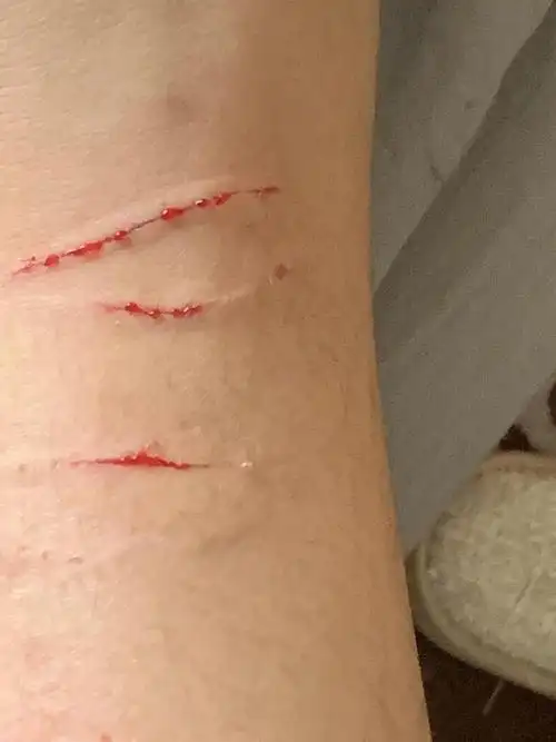 【讨论】老大和二胎突然打架哈气把我抓伤了(有出.