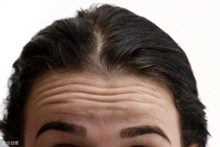 如何防治抬头纹?看完让你年轻十岁