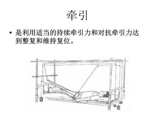 如小儿股骨干骨折用垂直悬吊皮牵引.ppt