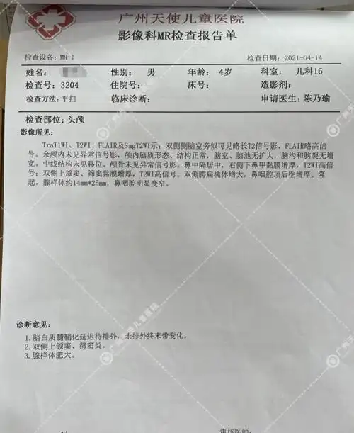 脑电图检查报告到院后,陈主任向凡凡妈了解了凡凡发病时的具体症状